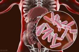 胃腸道間質腫瘤有哪些症狀？怎麼治療？