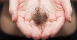 過億人“禿”遇救星！FDA批准首個斑禿系統療法，可恢復80％頭髮生長