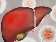肝臟作用大，保護好肝臟前提是警惕原發性肝癌