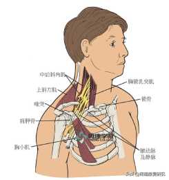 導致上背部和手臂疼痛的胸廓出口綜合徵及緩解動作